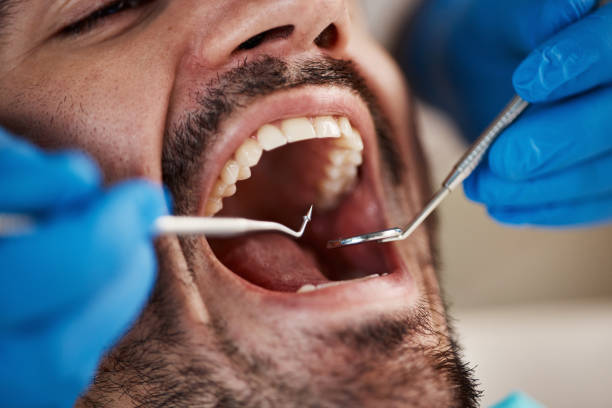 Best Oral Cancer Screening  in Warrensburg, IL